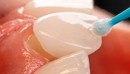 Foto Estética Dental - Dr. Alexandre Esteves