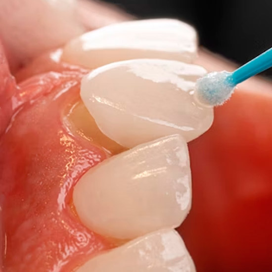 Foto Estética Dental - Dr. Alexandre Esteves